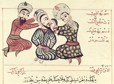 Ms Sup Turc 693 fol.76v استئصال رانولا من تحت اللسان ، 1466 بواسطة شرف الدين
